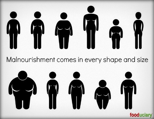malnourishment knows no shapes or sizes